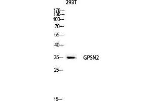 Western Blot (WB) analysis of 293T lysis using GPSN2 antibody.