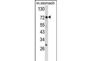 ZFP36 Antikörper  (AA 119-148)