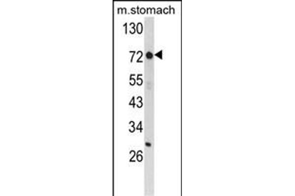 ZFP36 Antikörper  (AA 119-148)
