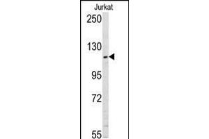 Western blot analysis of anti-USP11 Pab in Jurkat cell line lysates (35ug/lane).