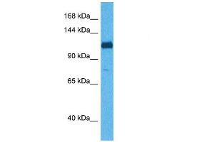Host:  Rabbit  Target Name:  ABI3BP  Sample Tissue:  Human 293T Whole Cell  Antibody Dilution:  1ug/ml (ABI3BP Antikörper  (C-Term))
