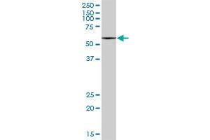 Western Blotting (WB) image for anti-Methylcrotonoyl-CoA Carboxylase 2 (Beta) (MCCC2) (AA 1-563) antibody (ABIN528514)