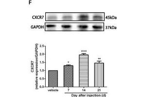 The CXCR7 and PI3K/Akt signaling pathways are involved in CPSP in the dorsal horn of the spinal cord. (GAPDH Antikörper)
