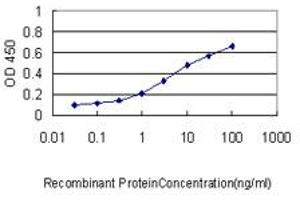 Detection limit for recombinant GST tagged GCLC is approximately 0. (GCLC Antikörper  (AA 528-637))