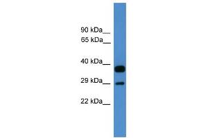 WB Suggested Anti-OTUB2 Antibody Titration: 0.