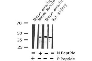 Western blot analysis of Phospho-JunB (Ser259) expression in various lysates