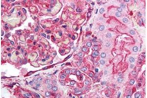 Human Kidney (formalin-fixed, paraffin-embedded) stained with ACTB antibody ABIN218328 at 1:100 followed by biotinylated goat anti-rabbit IgG secondary antibody ABIN481713, alkaline phosphatase-streptavidin and chromogen. (beta Actin Antikörper  (N-Term))