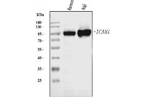 Western blot analysis of ICAM1 using anti-ICAM1 antibody (ABIN7601977).