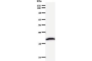 Western Blotting (WB) image for anti-Polymerase (DNA Directed), delta 2, Accessory Subunit (POLD2) (Regulatory Subunit 50) antibody (ABIN931066) (POLD2 Antikörper  (Regulatory Subunit 50))