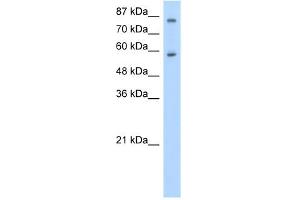 WB Suggested Anti-ZNF777 Antibody Titration:  0. (ZNF777 Antikörper  (C-Term))