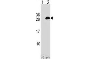 Western Blotting (WB) image for anti-Ubiquitin-Conjugating Enzyme E2T (Ube2t) antibody (ABIN2999419) (Ube2t Antikörper)