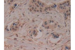 Immunohistochemistry (IHC) image for anti-Leukocyte Immunoglobulin-Like Receptor, Subfamily B (With TM and ITIM Domains), Member 2 (LILRB2) (AA 53-255) antibody (ABIN7444112)