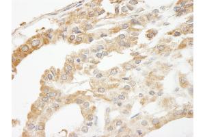 Immunohistochemistry (IHC) image for anti-ATP-Binding Cassette, Sub-Family F (GCN20), Member 2 (ABCF2) (AA 573-623) antibody (ABIN7448399)