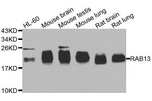 Western blot analysis of extracts of various cell lines, using RAB31 antibody. (RAB31 Antikörper  (AA 1-195))