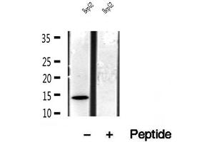 Western blot analysis of extracts of HepG2 cells, using CISD1 antibody. (CISD1 Antikörper  (Internal Region))