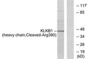 Western blot analysis of extracts from HeLa cells, using KLKB1 (heavy chain,Cleaved-Arg390) Antibody.