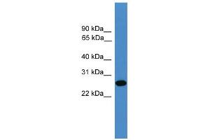 WB Suggested Anti-TIMP2 Antibody Titration: 0. (TIMP2 Antikörper  (N-Term))