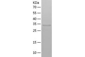 Western Blotting (WB) image for 2,4-Dienoyl CoA Reductase 1, Mitochondrial (DECR1) (AA 35-335) protein (His tag) (ABIN7121601) (DECR1 Protein (AA 35-335) (His tag))