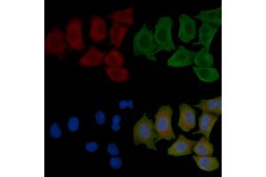 ABIN6262389 and ABIN6266906 staining Hela cells(45 min of heat-shock) by IF/ICC.
