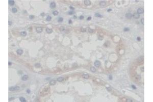 Detection of SGSH in Human Kidney Tissue using Polyclonal Antibody to N-Sulfoglucosamine Sulfohydrolase (SGSH) (SGSH Antikörper  (AA 21-389))