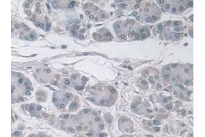 Immunohistochemistry (IHC) image for anti-Ubiquitin (Ub) (AA 1-229) antibody (ABIN7443803)