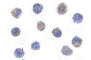 Immunocytochemistry of AIF in K562 cells with AP30031PU-N AIF antibody at 5 μg/ml. (AIF Antikörper  (C-Term))