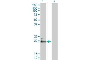 Western Blot analysis of HAND2 expression in transfected 293T cell line by HAND2 monoclonal antibody (M03), clone 3E3. (HAND2 Antikörper  (AA 135-216))