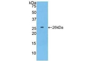 Detection of Recombinant TPPP, Human using Polyclonal Antibody to Tubulin Polymerization Promoting Protein (TPPP) (Tppp Antikörper  (AA 8-210))