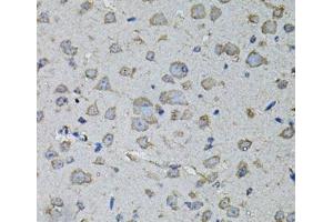 Immunohistochemistry of paraffin-embedded Mouse brain using IL1A Polyclonal Antibody at dilution of 1:100 (40x lens). (IL1A Antikörper)