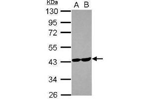 WB Image Sample (30 ug of whole cell lysate) A: U87-MG B: MCF-7 10% SDS PAGE antibody diluted at 1:1000 (ALDOC Antikörper)