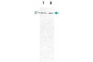 Western Blot analysis of HIP1R protein in HeLa cell (Lane 1) and rat brain (Lane 2) lysates, using HIP1R monoclonal antibody, clone 1E5  at 1 : 1000 dilution. (HIP1R Antikörper)