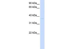 WB Suggested Anti-GDAP1L1 Antibody Titration:  0.