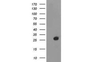 Western Blotting (WB) image for anti-Deoxythymidylate Kinase (Thymidylate Kinase) (DTYMK) antibody (ABIN1497922) (DTYMK Antikörper)