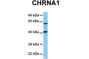 Host:  Rabbit  Target Name:  CHRNA1  Sample Tissue:  Human Fetal Lung  Antibody Dilution:  1. (CHRNA1 Antikörper  (C-Term))