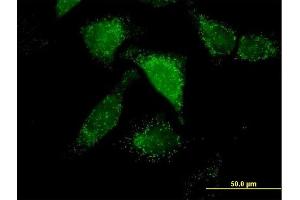 Immunofluorescence of purified MaxPab antibody to ACOX1 on HeLa cell. (ACOX1 Antikörper  (AA 1-660))