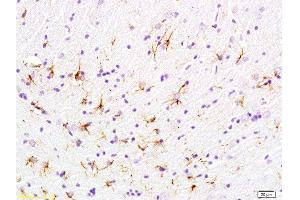 Formalin-fixed and paraffin embedded rat brain labeled with Anti-phospho-GFAP Polyclonal Antibody, Unconjugated  at 1:200 followed by conjugation to the secondary antibody and DAB staining (GFAP Antikörper  (pSer8))