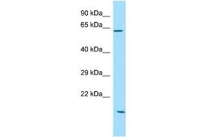 WB Suggested Anti-SOWAHC Antibody Titration: 1. (ANKRD57 Antikörper  (C-Term))
