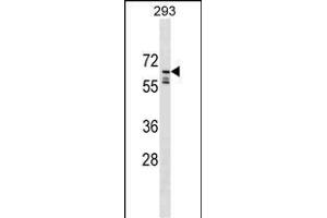 IL2 Antibody (C-term) (ABIN1537279 and ABIN2849712) western blot analysis in 293 cell line lysates (35 μg/lane). (PPIL2 Antikörper  (C-Term))