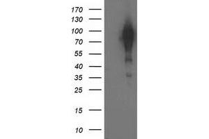 HEK293T cells were transfected with the pCMV6-ENTRY control (Left lane) or pCMV6-ENTRY BCAR1 (Right lane) cDNA for 48 hrs and lysed. (BCAR1 Antikörper)