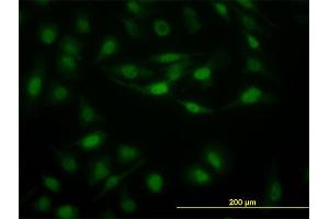 Immunofluorescence of monoclonal antibody to STAT5B on HeLa cell. (STAT5B Antikörper  (AA 678-787))