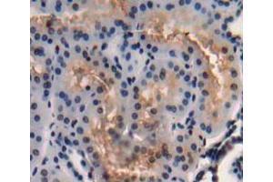 Used in DAB staining on fromalin fixed paraffin- embedded Kidney tissue (C3orf15 Antikörper  (AA 29-181))