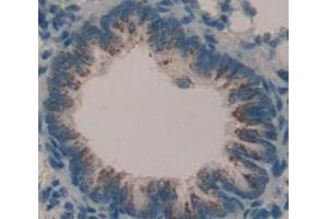 Immunohistochemistry (IHC) image for anti-Fibulin 3 (FBLN3) (AA 166-445) antibody (ABIN1858814)