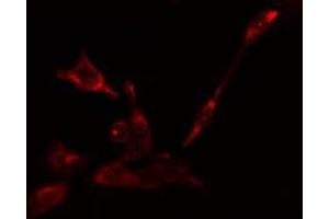 ABIN6275123 staining Hela cells by IF/ICC. (EIF5B Antikörper  (C-Term))