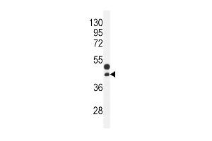 CTGF Antibody (Center) (ABIN392205 and ABIN2841905) western blot analysis in mouse bladder tissue lysates (35 μg/lane). (CTGF Antikörper  (AA 134-159))