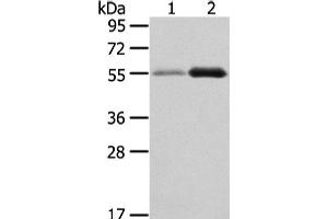 Western Blot analysis of Human normal stomach and thyroid cancer tissue using XKR3 Polyclonal Antibody at dilution of 1/330 (XKR3 Antikörper)