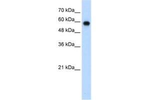Western Blotting (WB) image for anti-SWI/SNF Related, Matrix Associated, Actin Dependent Regulator of Chromatin, Subfamily D, Member 2 (SMARCD2) antibody (ABIN2461675) (SMARCD2 Antikörper)