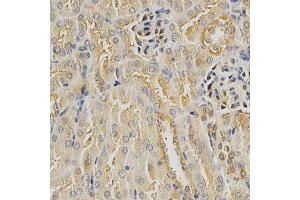 Immunohistochemistry of paraffin-embedded mouse kidney using HDAC6 antibody (ABIN5997884) at dilution of 1/100 (40x lens). (HDAC6 Antikörper)