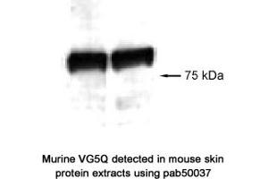 Image no. 1 for anti-Angiogenic Factor with G Patch and FHA Domains 1 (AGGF1) (AA 300-400) antibody (ABIN363346) (AGGF1 Antikörper  (AA 300-400))