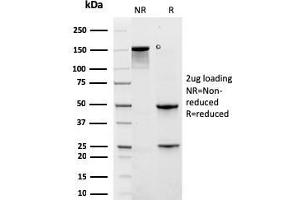 SDS-PAGE Analysis Purified KRT6A Recombinant Mouse Monoclonal Antibody (rKRT6A/2100). (Rekombinanter KRT6A Antikörper)
