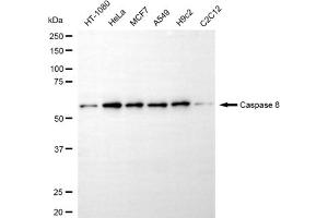 Western blotting analysis using caspase 8 antibody (ABIN7797904).